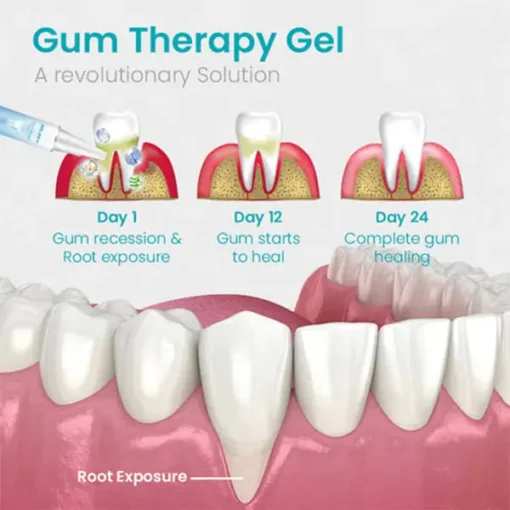 NESLEMY™ Gum Shield Therapy Gel