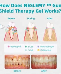 NESLEMY™ Gum Shield Therapy Gel