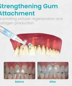 NESLEMY™ Gum Shield Therapy Gel