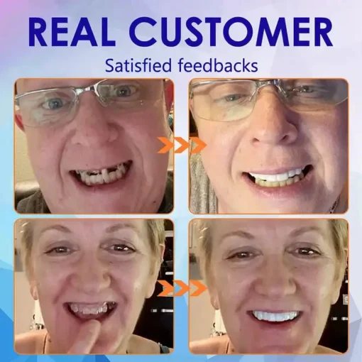 NESLEMY™-🦷Advanced Customized Full Denture Set