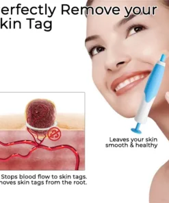 NESLEMY™ At-home Skin Tag Removal Pen