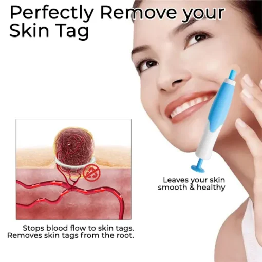 NESLEMY™ At-home Skin Tag Removal Pen