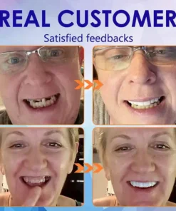 NESLEMY®-🦷Advanced Customized Full Denture Set