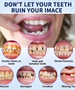 NESLEMY™ - Advanced Full Denture Set🦷