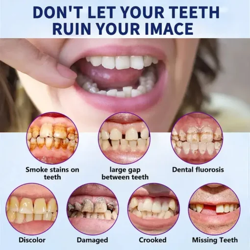 NESLEMY™ - Advanced Full Denture Set🦷