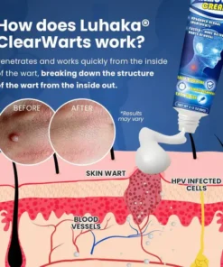 NESLEMY™ ClearWarts Instant Blemish Removal Cream