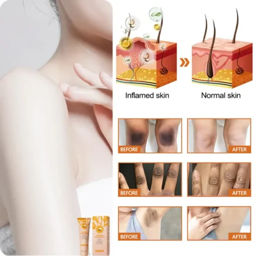 NESLEMY™ Purifying Exfoliating Gel
