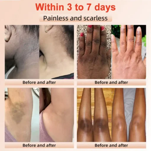 NESLEMY™ Purifying Exfoliating Gel
