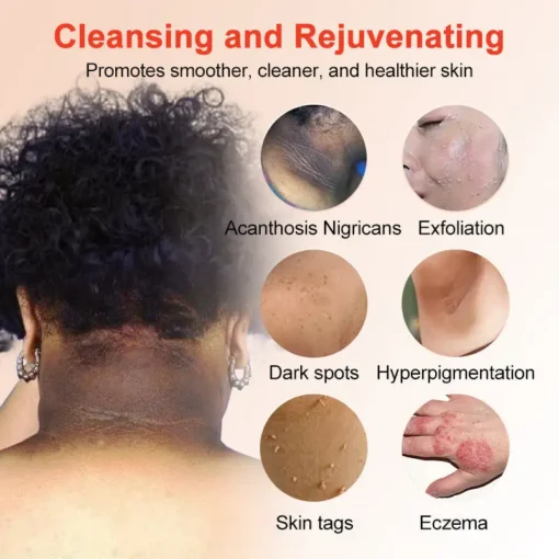 NESLEMY™ Purifying Exfoliating Gel