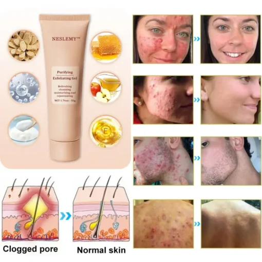 NESLEMY™ Purifying Exfoliating Gel