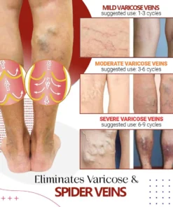 NESLEMY™Varicose Vein Relief Cream