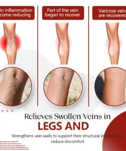 NESLEMY™Varicose Vein Relief Cream