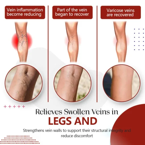 NESLEMY™Varicose Vein Relief Cream