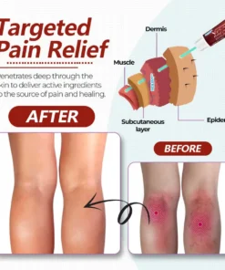 NESLEMY™Varicose Vein Relief Cream