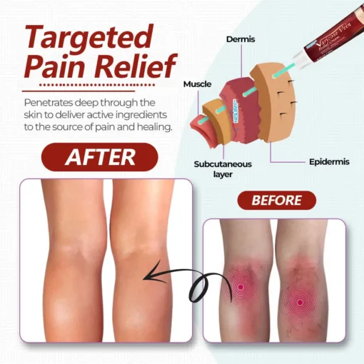 NESLEMY™Varicose Vein Relief Cream
