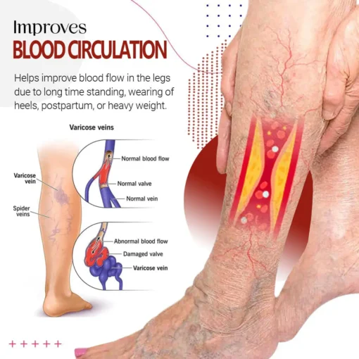 NESLEMY™Varicose Vein Relief Cream