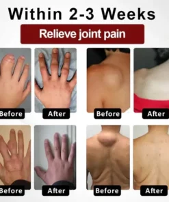 NESLEMY™ Horse Chestnut Arthritis Massage Cream