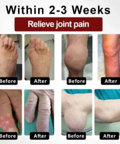 NESLEMY™ Horse Chestnut Arthritis Massage Cream