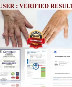 NESLEMY™ Horse Chestnut Arthritis Massage Cream