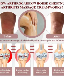 NESLEMY™ Horse Chestnut Arthritis Massage Cream