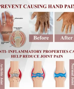 NESLEMY™ Horse Chestnut Arthritis Massage Cream