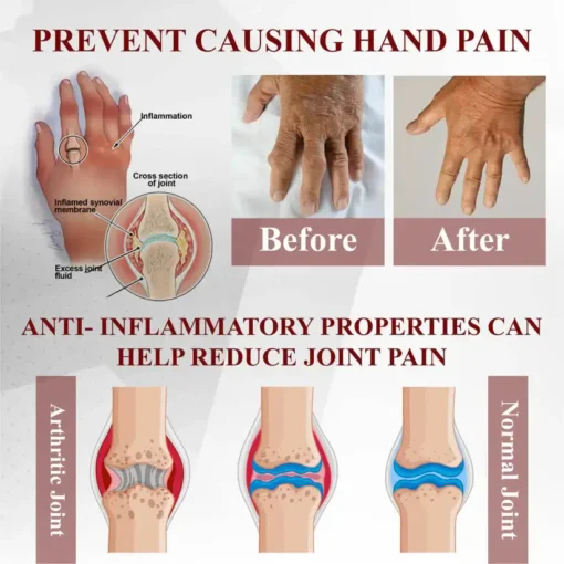 NESLEMY™ Horse Chestnut Arthritis Massage Cream