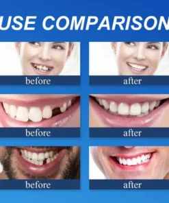 NESLEMY™ --Advanced Customized Full Denture Set