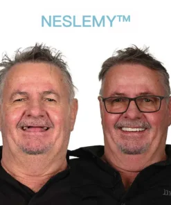 NESLEMY™ GelFit Dentures