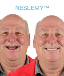 NESLEMY™ GelFit Dentures