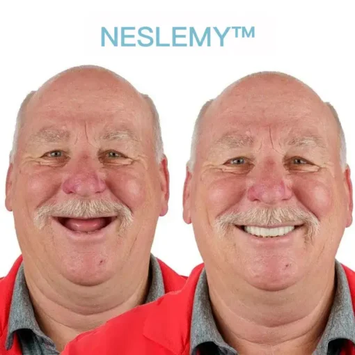 NESLEMY™ GelFit Dentures