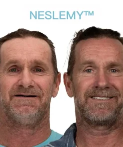 NESLEMY™ GelFit Dentures