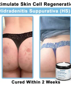 Neslemy® Magnesium skin repair cream