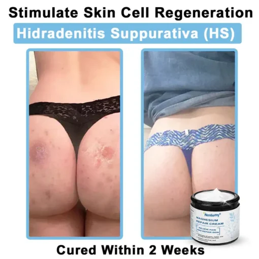 Neslemy® Magnesium skin repair cream