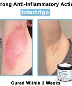 Neslemy® Magnesium skin repair cream