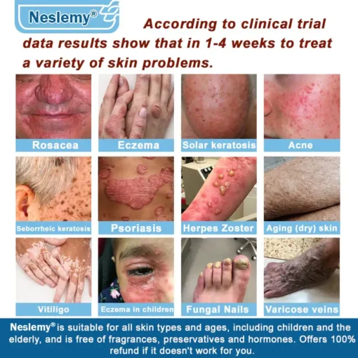 Neslemy® Magnesium skin repair cream