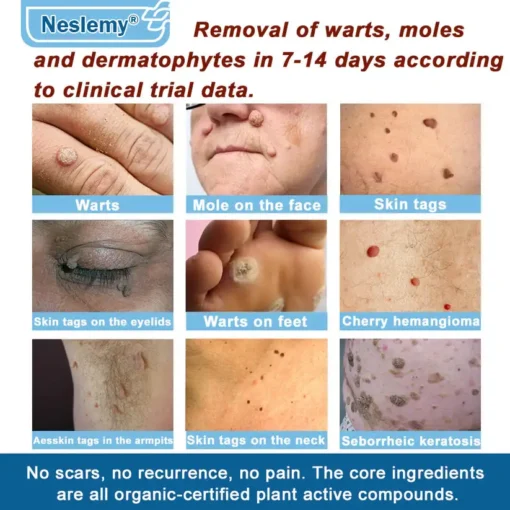 Neslemy® Magnesium skin repair cream