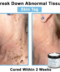 Neslemy® Magnesium skin repair cream