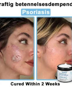 Neslemy® Magnesium skin repair cream