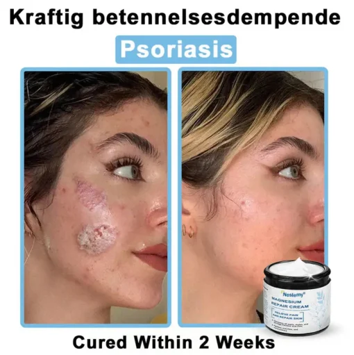Neslemy® Magnesium skin repair cream