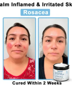 Neslemy® Magnesium skin repair cream