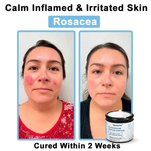 Neslemy® Magnesium skin repair cream