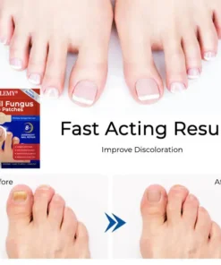 NESLEMY® Nail Fungus Care Patches