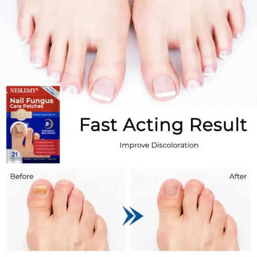 NESLEMY® Nail Fungus Care Patches