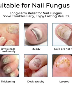 NESLEMY® Nail Fungus Care Patches