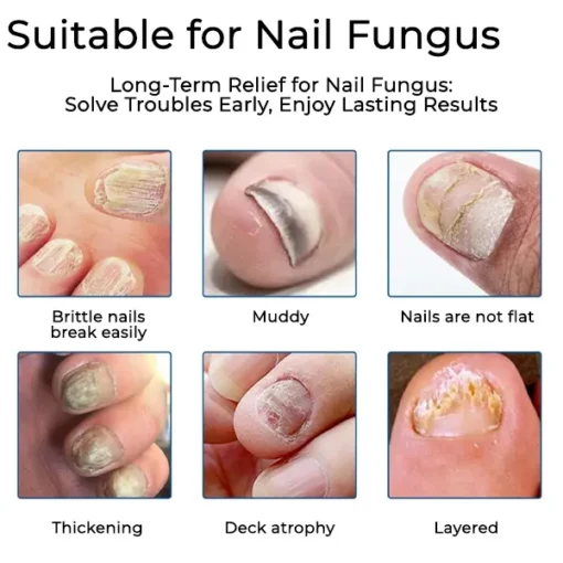 NESLEMY® Nail Fungus Care Patches