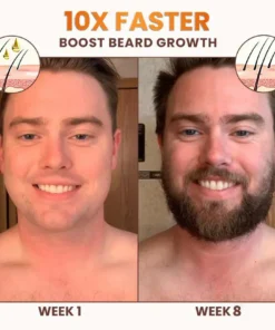NESLEMY™ PremiumLocks Biotin Hair & Beard Growth Spray