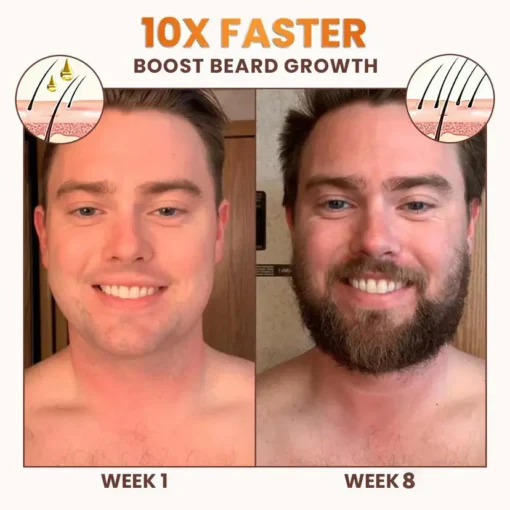 NESLEMY™ PremiumLocks Biotin Hair & Beard Growth Spray