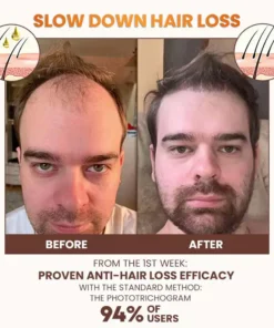 NESLEMY™ PremiumLocks Biotin Hair & Beard Growth Spray