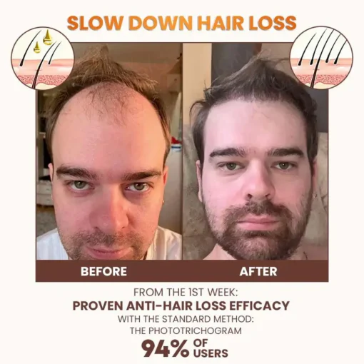 NESLEMY™ PremiumLocks Biotin Hair & Beard Growth Spray