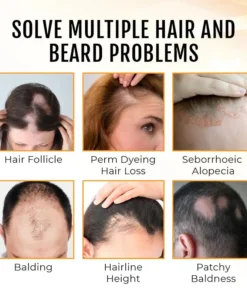 NESLEMY™ PremiumLocks Biotin Hair & Beard Growth Spray